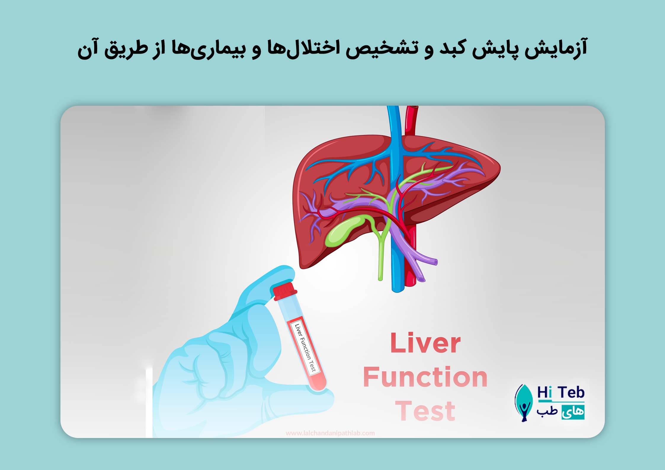 آزمایش پایش کبد